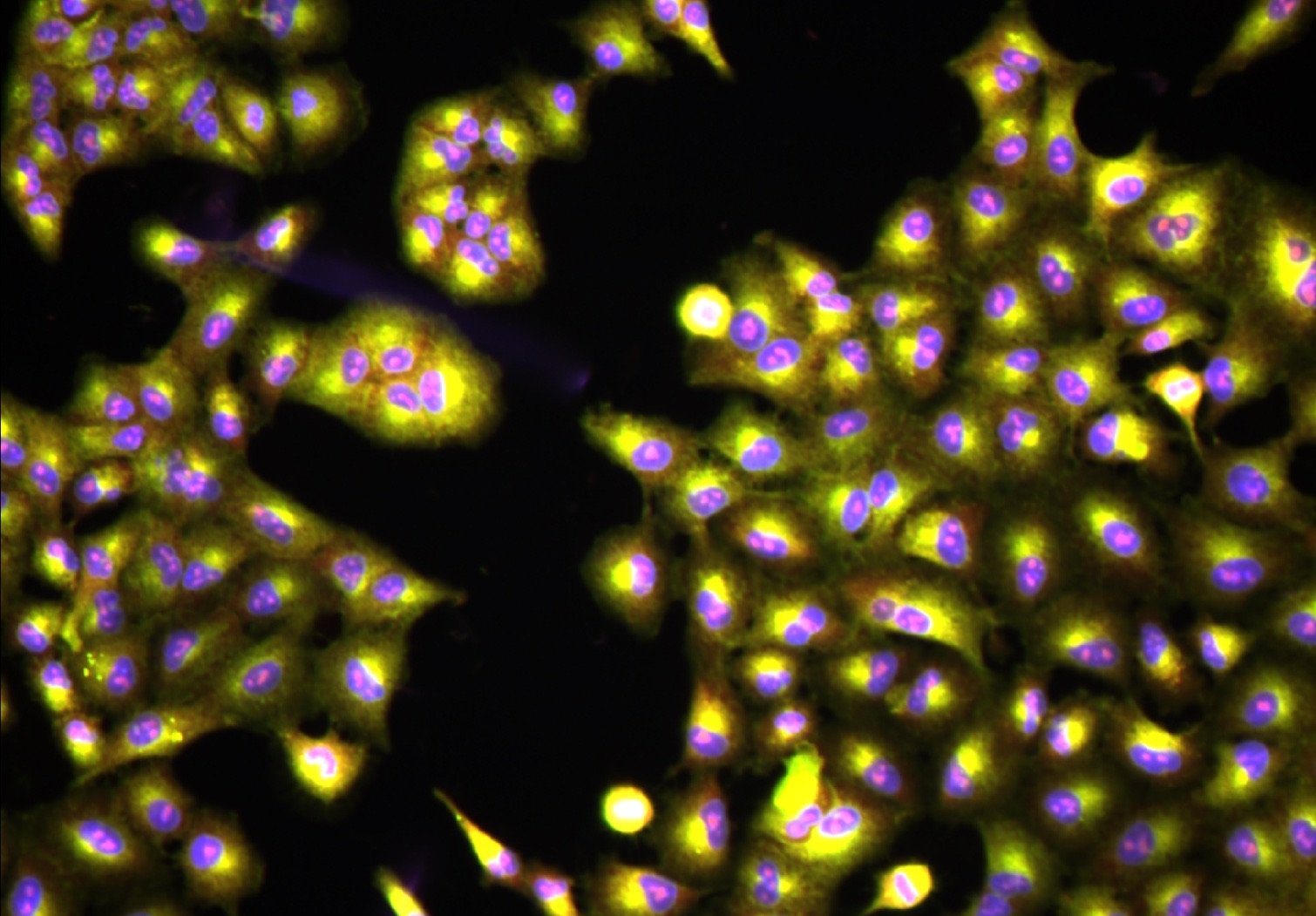 A Cell Painting field from the JUMP pilot plate CPJUMP1, imaged on an Opera Phenix and opened in the Find Nuclei Viewer straight from the Cell Painting Gallery